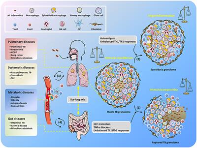 Frontiers | Mycobacterium tuberculosis: An Adaptable ... tb pneumonia diagram 